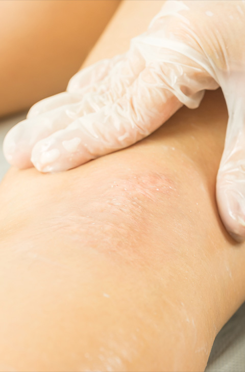 person wearing gloves gently examining a rash on a knee focusing on skin care for effective treatment and healing nine barriers to healthy skin